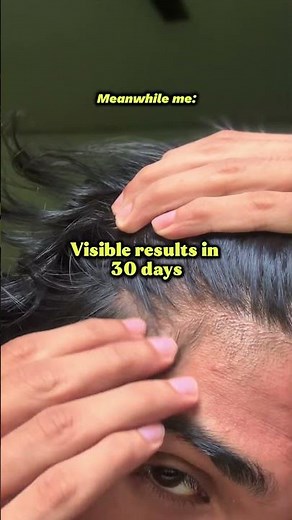 Product 🔗 in related video👆🏻