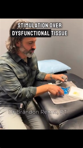 Discover a faster, more effective path to healing with Astym® therapy—a clinically proven treatment designed to regenerate soft tissue and eliminate pain at the source. Whether you’re recovering from an injury, battling chronic discomfort, or looking to get back to the activities you love, Astym helps your body repair and rebuild naturally. ✨ Reduce pain ✨ Improve mobility ✨ Restore function Feel the difference of science-backed healing. Recover stronger with Astym® therapy. Call us today to fin