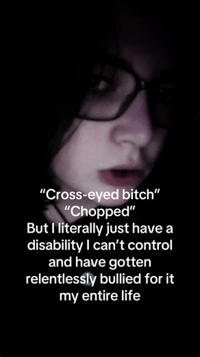 #disability #CREEPsong #doicreepyouout #crosseyed #idk | cross eyed
