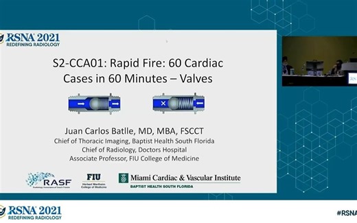 （快速射击：60分钟读60个心脏病例）Rapid Fire_ 60 Cardiac Cases in 60 Minutes _ RSNA 2021