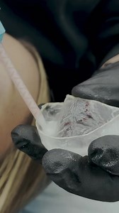 Trust the process😉 24 hour turn around on the permanents! #teeth #crowns #smile #makeover | Smile Again Dental - Texas