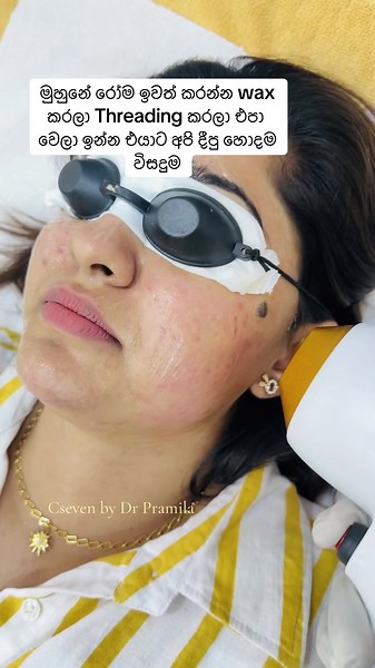 Laser Hair Removal: Benefits Over Waxing and Threading