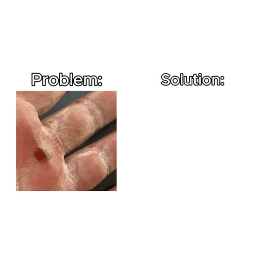 Real 😭 #calluses #compressionshirt #gymwear #gymshackles #gym | compression shirts