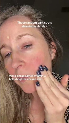 Vitamin C is one of the easiest upgrades you can make to your skincare routine.