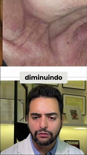 Câncer de cabeça e pescoço: causas e sinais de alerta