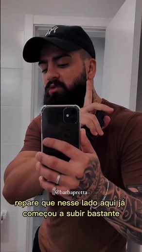 Porque decidi usar o Folidil? #folidil #barba #barbapreta #minoxidil #short #barbearia #shorts