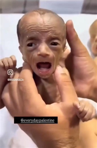 This is what a starving newborn looks like during Israel’s Holocaust on Gaza. The depraved, sociopathic Zionist regime is blocking baby formula and starving infants to death. Fk Israel. Fk every single enabler of this genocide. #GazaHolocaust | Suhair Nafal