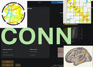 CONN功能连接系列视频-06 MATLAB代码批处理 | 任务态fMRI 功能连接 SBC gPPI