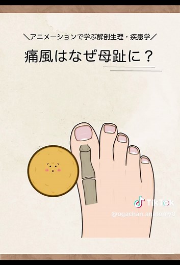 痛風はなぜ足の親指に起こるのか？看護学生向け解説