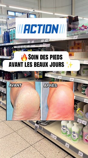 Soin des pieds avant les beaux jours : routine Action à découvrir