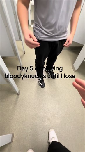 #fyp #fypシ゚viral #bloodyknucles #fyp #fypシ゚viral | coin game knuckles