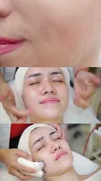 HydraFacial Explained – Benefits, Process & Results! #skincare #hydrafacial