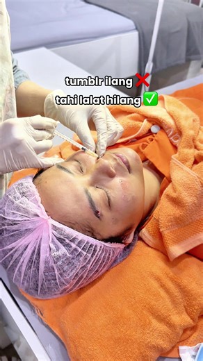 tumblr hilang ❌ tahi lalat ilang ✅ siapa yang mau juga 😋?? #laser #tahilalat #klinikkecantikan