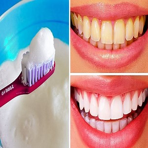 87K views · 2.2K reactions | How to Whiten Your Yellow Teeth Naturally at Home in 2 Minutes | Teeth Whitening at Home in 2 minutes | ELEGANT BEAUTY | Facebook
