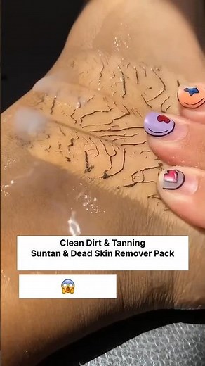 You Won’t Believe This Feet Cleaning Transformation!”#ytshorts#shortsfeed#yputubeshort#feetwhitening