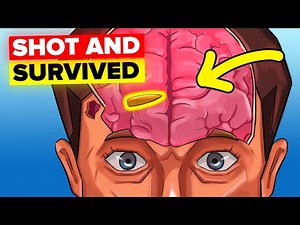 Survive Getting Shot (Minute by Minute)