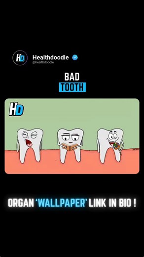 Health • Wellness • Animation on Instagram: "A bad tooth usually means the tooth is damaged by decay, infection, or injury. When bacteria break down the enamel, cavities form, causing sensitivity and pain. If untreated, the decay reaches the pulp, leading to severe toothache, swelling, or even abscess (pus). Bad teeth can also cause bad breath, difficulty chewing, gum infection, and can spread bacteria to other parts of the body. 🎥Follow @healthdoodle for more Video Credit: Internet #BadTooth #