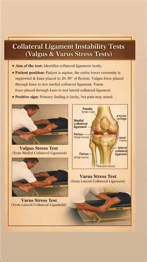 Collateral Ligament Instability Tests(Valgus & Varus Stress Tests)• #painrelief #kneepainrelief