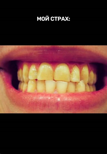 #WW314650 - ❗️оригинальный арт на отбеливающую пасту, которая устраняет запах и расщепляет налет благодаря диоксиду кремния в составе. Я в шоке, но результат виден с первого применения #отбеливаниезубов #уход