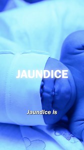 Why does jaundice happen? | Facts that will blow your mind