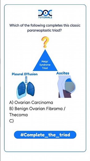 Meigs’ Syndrome Triad Explained | Ascites, Pleural Effusion & Ovarian Fibroma