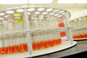 Transgene stands out following licensing agreement with NEC Bio