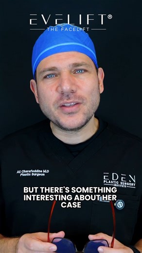 EVELift® | When the bone structure is strong, the focus shifts to skin quality and refinement. 52 years young, our lovely patient has excellent bone... | Instagram