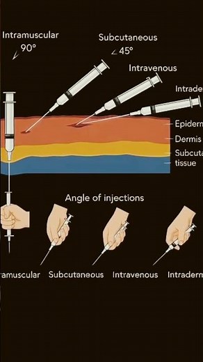 Injection Angle Guide: IM, SC, IV, and ID Techniques with Skin Layers for Nursing Learners #shorts