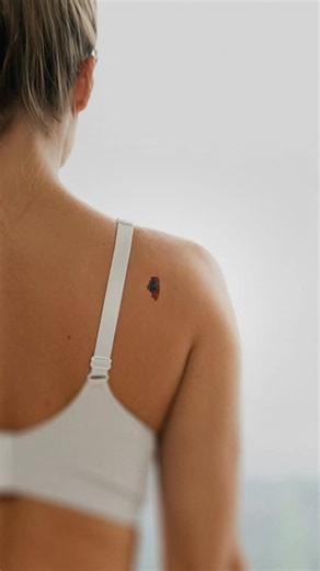 1 in 5 Americans develop skin cancer in their lifetime. Catch it early. Book your yearly skin check at Pinnacle Dermatology. | Pinnacle Dermatology