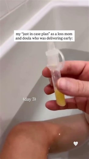 i had a scheduled cesarean at 37+3 with my daughter as a loss mom, it was hard for me to envision