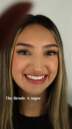 Missing tooth, crowding, and heavy staining? This wasn't a simple fix..