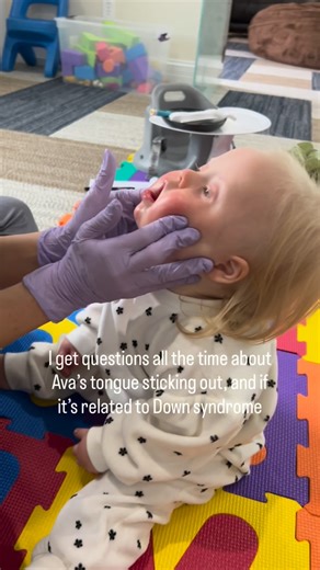 Kristin Walls | Down Syndrome Advocate on Instagram: "Why does Ava’s tongue stick out so much? I get this question almost daily. The answer is hypotonia or low muscle tone. We are seeing a myofunctional therapist in Kentucky. Her name is Ashleigh Guffey @kentuckybreathenetwork if you are local. She’s been amazing with Ava! Her mouth muscles are getting so much stronger. The fact she can drink from a straw is HUGE! We made the investment and bought @talktoolstherapy to work at home with her. I al