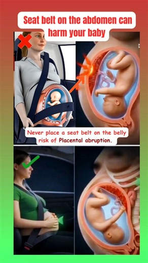Pregnancy Warning: Seat Belt on the Abdomen Can Risk Your Baby! 🤰⚠️ #shorts #health