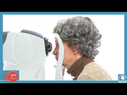 Auto Fundus Camera - About the Nidek AFC