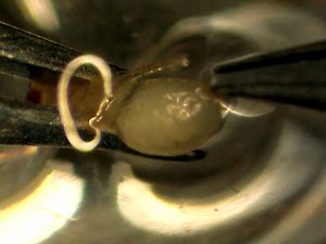 Simple Method for Fluorescence DNA In Situ Hybridization to Squashed Chromosomes