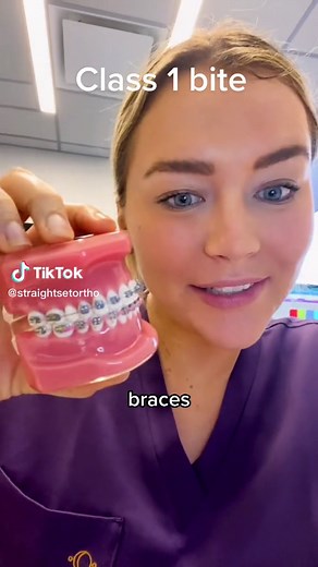 Understanding Class 1 Bite: Tips and Strategies for Braces and Invisalign