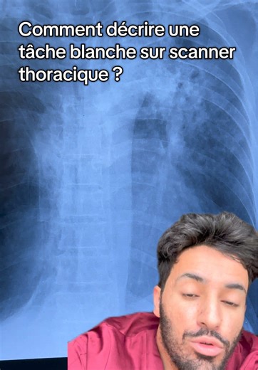 Tâche blanche sur scanner thoracique : explications