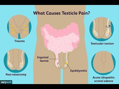 What Causes Testicle Pain and How to Treat It | testicular pain home remedy