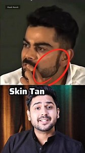 Remove Tan And Glowing Skin Secret | Skin Care Tips #tan #skin #shorts