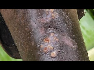 Elkana's follow up jigger digging #1 long video found @ riseupsociety.net & ruskenya.org