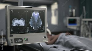 X-ray equipment imaging the patients chest at the healthcare hospital. X-ray imaging of the chest in the check-up ward. X-ray imaging procedure detecting cancerous growth inside the chest.