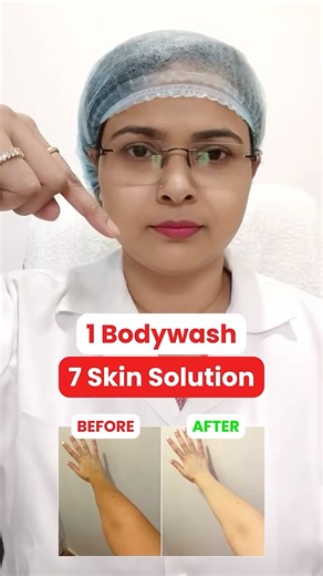 Transform your skin with Woodoo Mystique Bodywash🌸 #woodoo #pigmentation #bodyacne #skincare #short