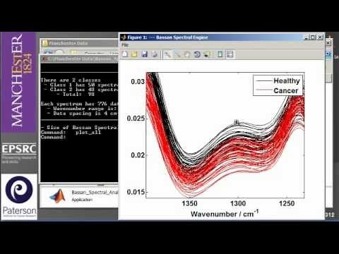 Raman / Fourier Transform Infrared (FTIR) / Mass spectroscopy data analysis & chemometrics