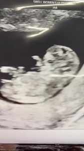 9.9K views · 180 reactions | It was another wild ride in the Pearson...