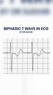 Biphasic T wave | ECG by Dr Sudhir | #ecginterpretation #neetpg #internalmedicine