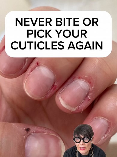 Here's my tip on how to stop biting your #cuticles #cuticlecare #howtostop
