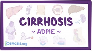 Cirrhosis: Nursing process (ADPIE): Video, Causes, & Meaning | Osmosis