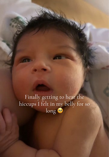 Understanding Baby Hiccups: Tips for New Moms