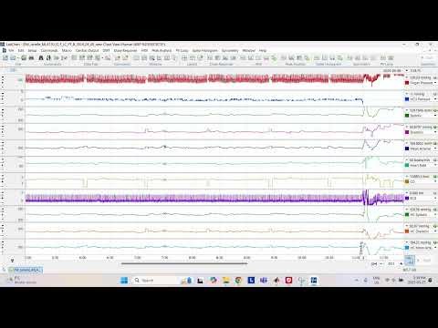 LabChart Analysis Tutorial - CPER Lab - 2025 03 27