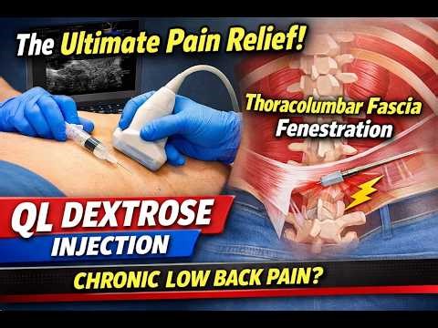 USG Guided QL Muscle 5% Dextrose Injection & Thoracolumbar Fascia Fenestration |Chronic LowBackPain